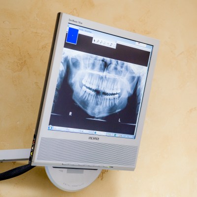 Dental X-Rays & Diagnostics