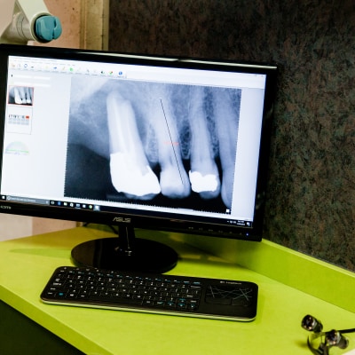 Dental X-Rays & Diagnostics